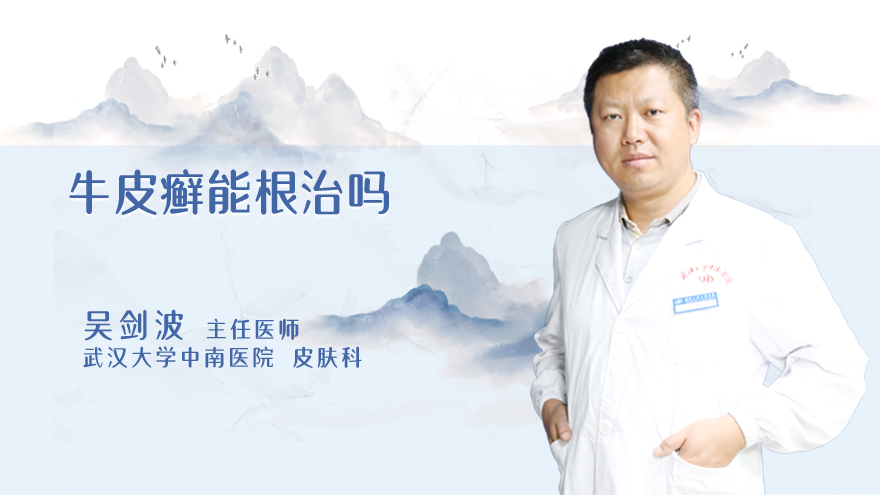 牛皮癣能根治吗