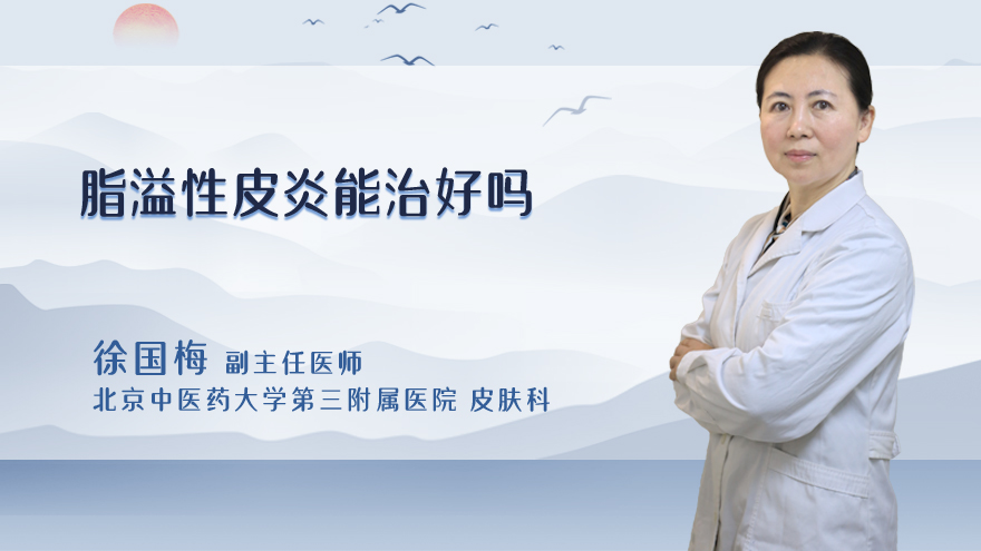 脂溢性皮炎能治好吗