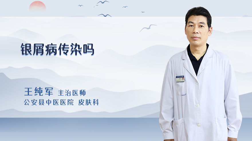 银屑病传染吗