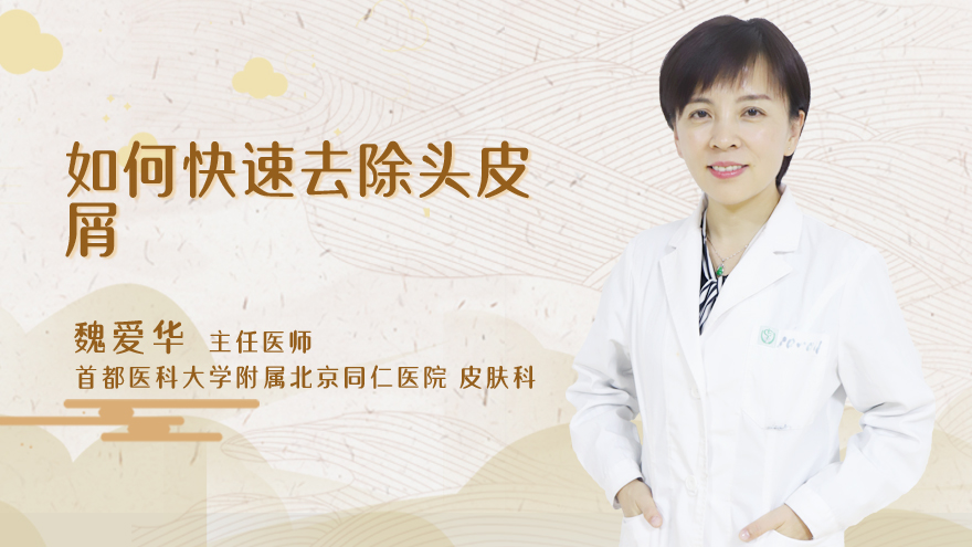 如何快速去除头皮屑