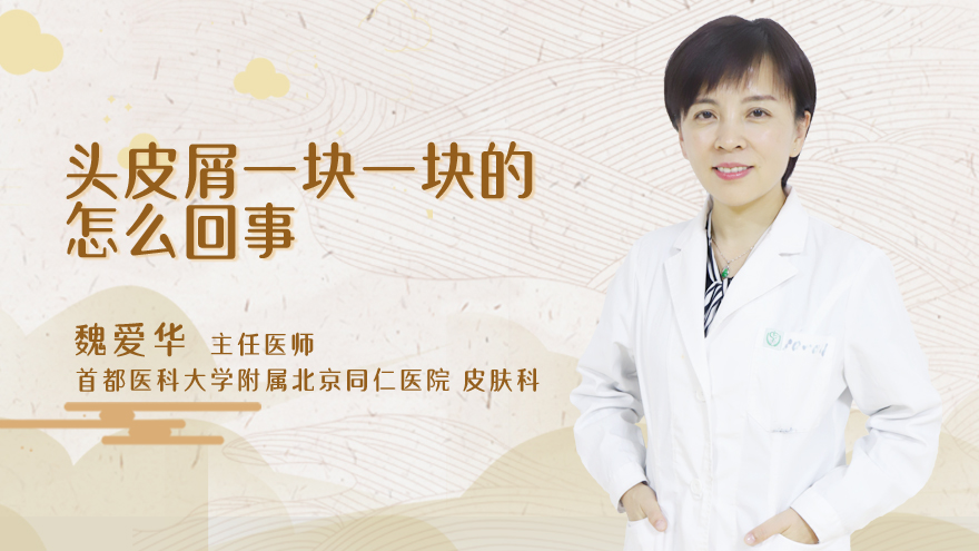 头皮屑一块一块的怎么回事