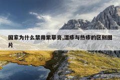 <b>国家为什么禁用紫草膏,湿疹与热疹的区别图片</b>